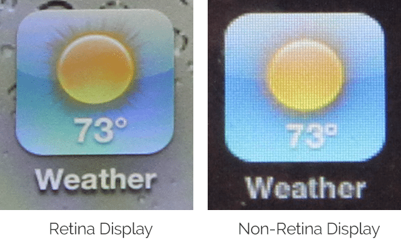 retina